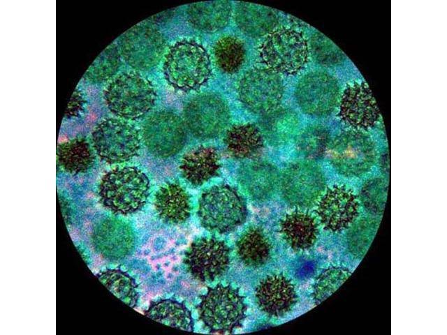 10MP USB2.0 Microscope Digital Camera V385065