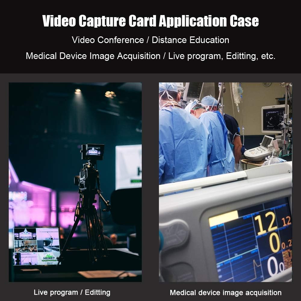 SDI to USB3.0 Video Capture 1080P 60fps E388